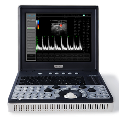 d3便攜式全數字彩色多普勒超聲診斷系統