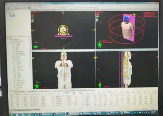 放射治療信息管理系統xhrtims新華